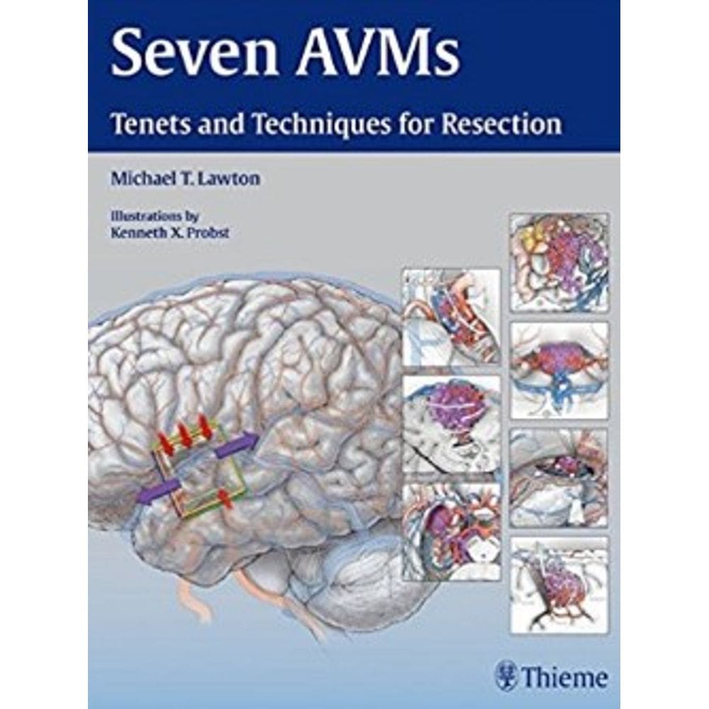 Seven Avms