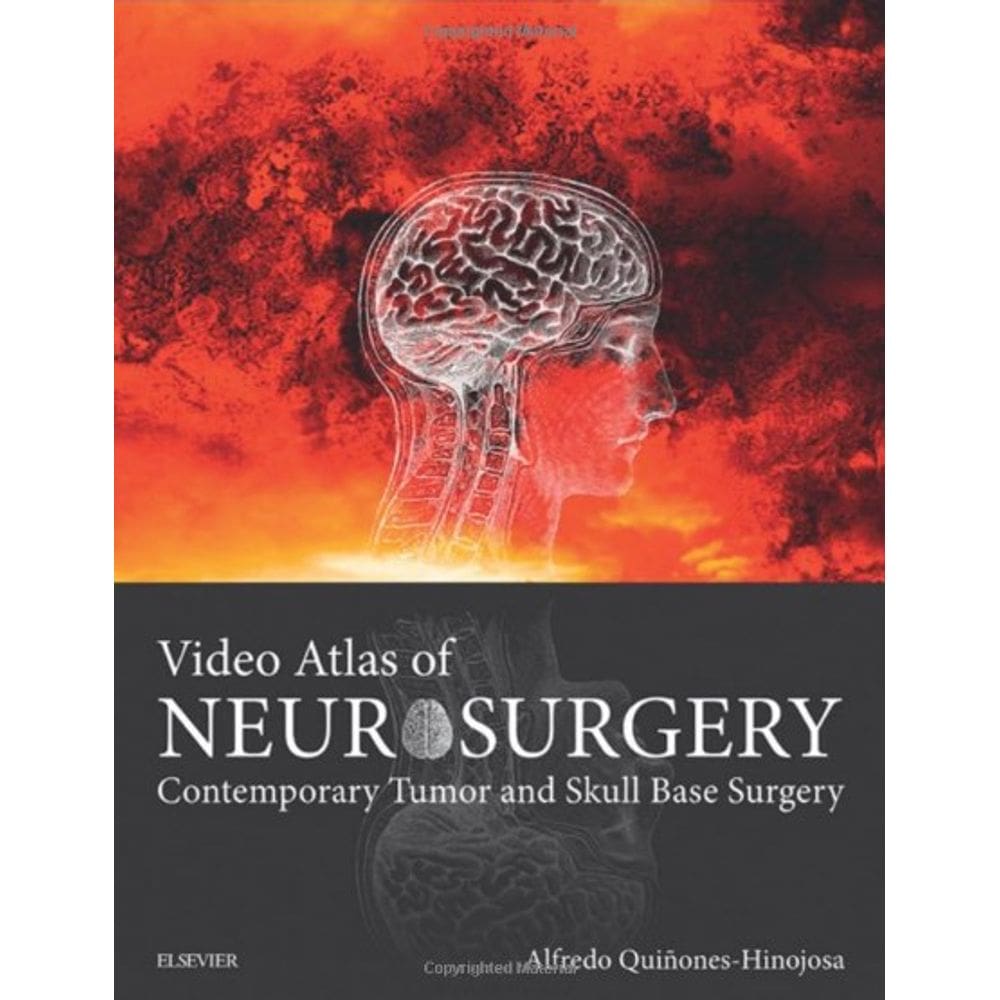 Video Atlas Of Neurosurgery: Contemp Tumor And Skull Base Surg