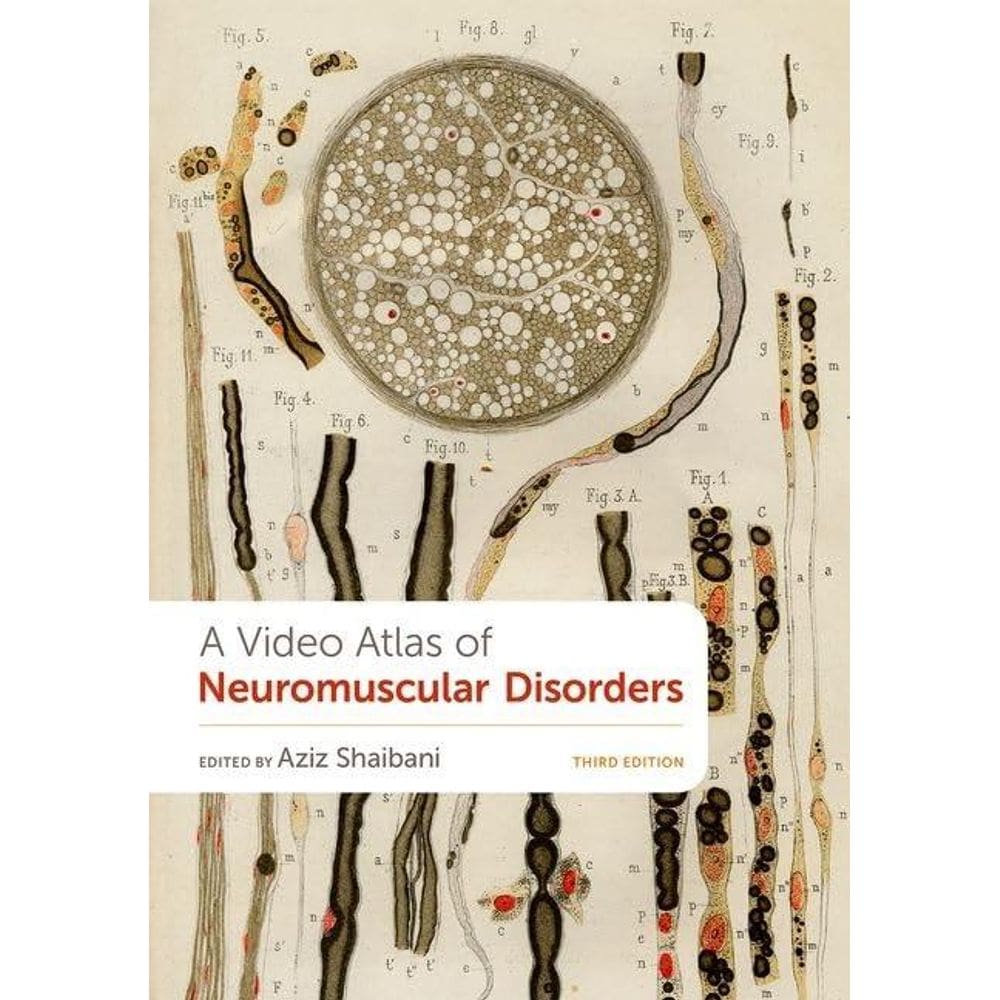 A Video Atlas Of Neuromuscular Disorders