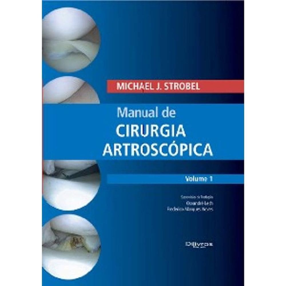Manual de Cirurgia Artroscópica: Vol. 1