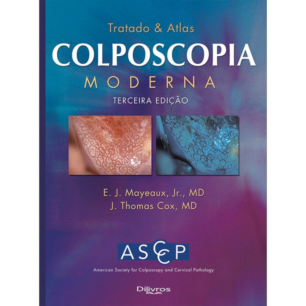 Tratado E Atlas Colposcopia Moderna