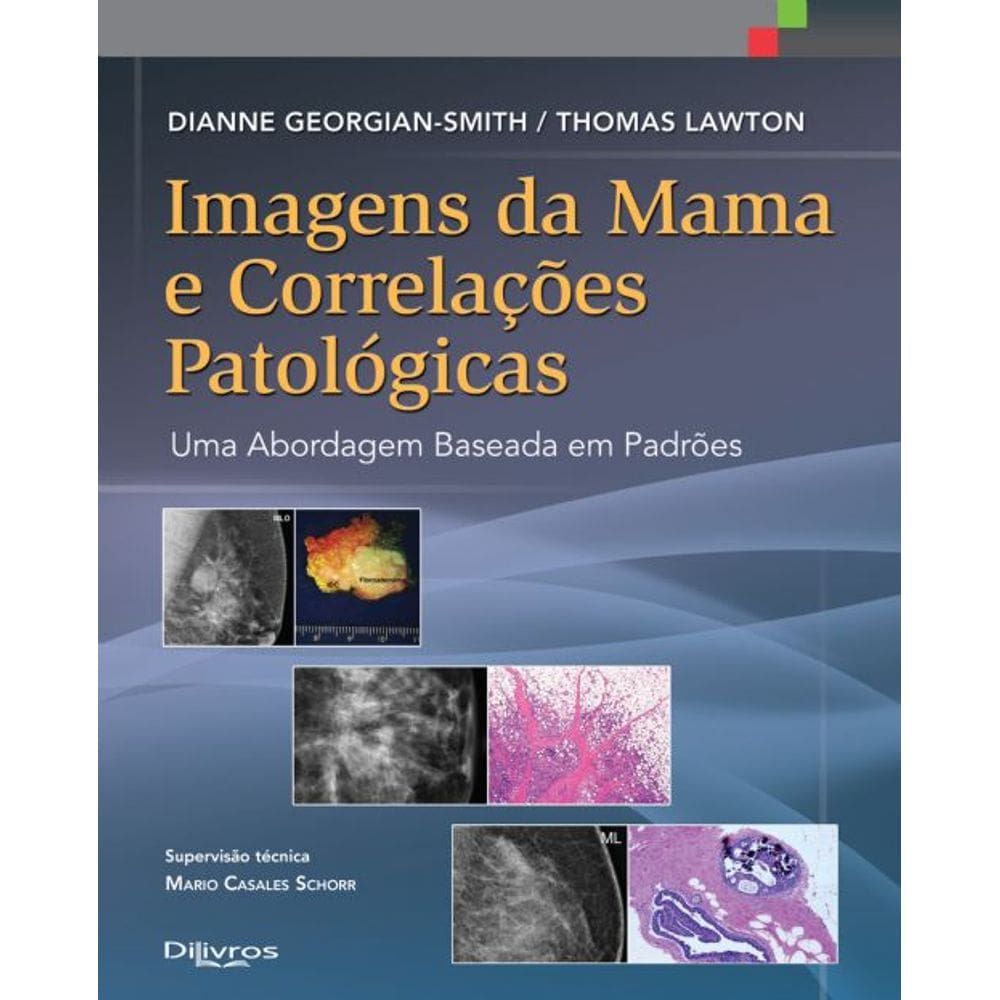 Imagens Da Mama E Correlacoes Patologicas - Uma Abordagem Baseada Em Padroe