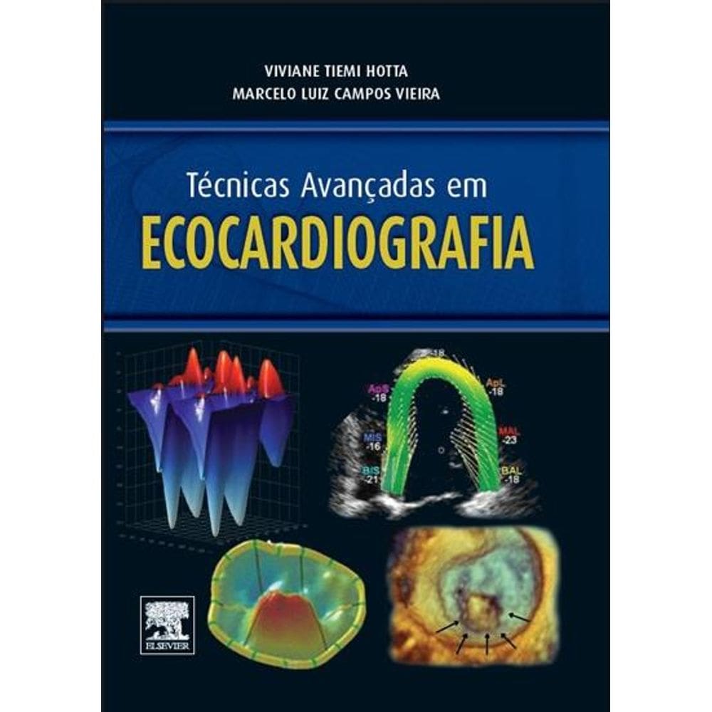 Técnicas Avançadas Em Ecocardiografia