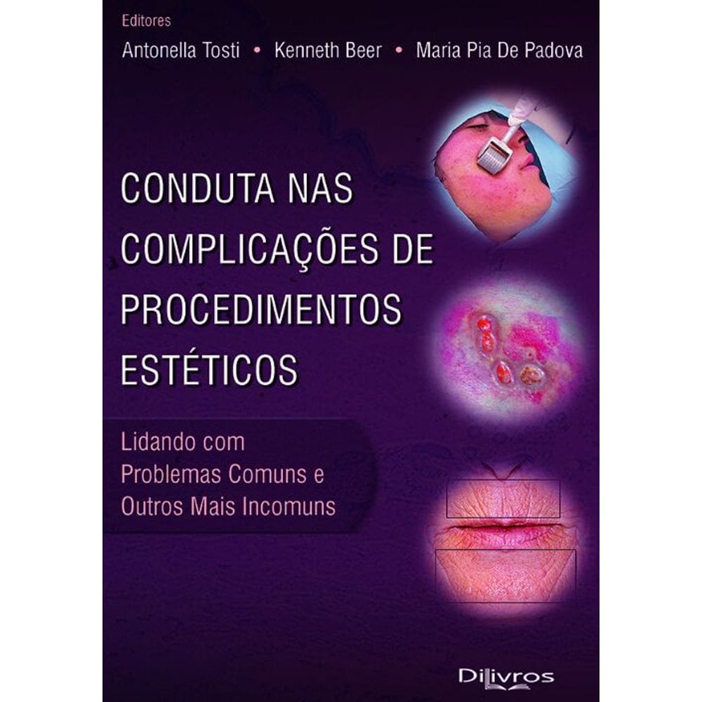 Conduta Nas Complicacoes De Procedimentos Esteticos Lidando Com Problemas