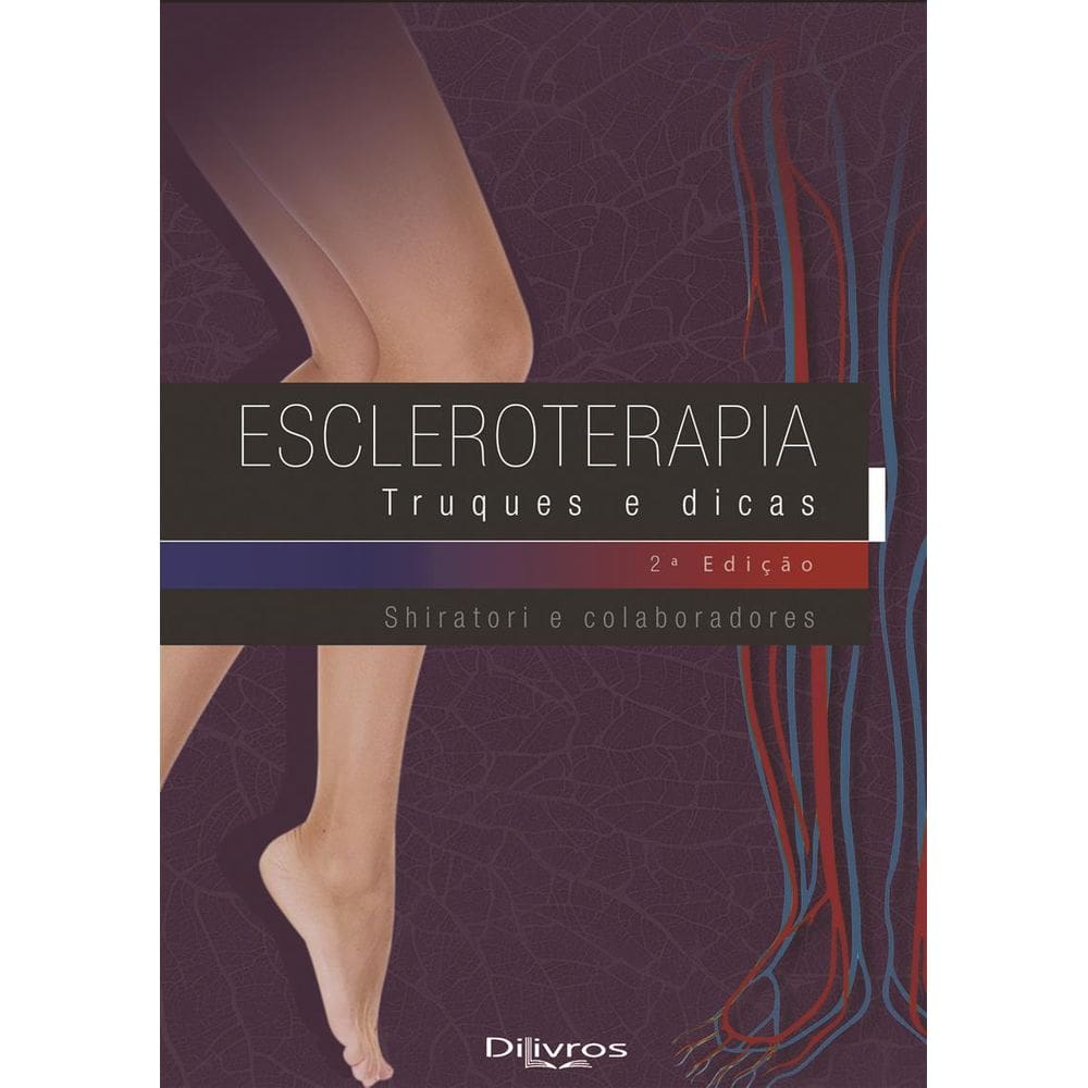 Escleroterapia Truques E Dicas