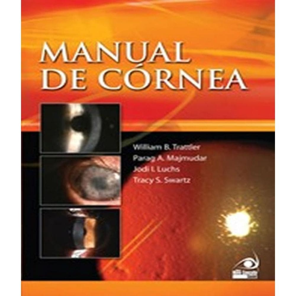 Livro Manual De Cornea