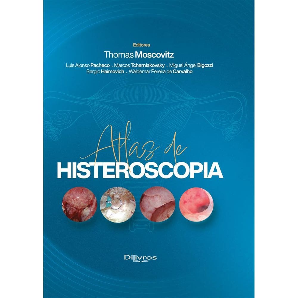 Atlas De Histeroscopia