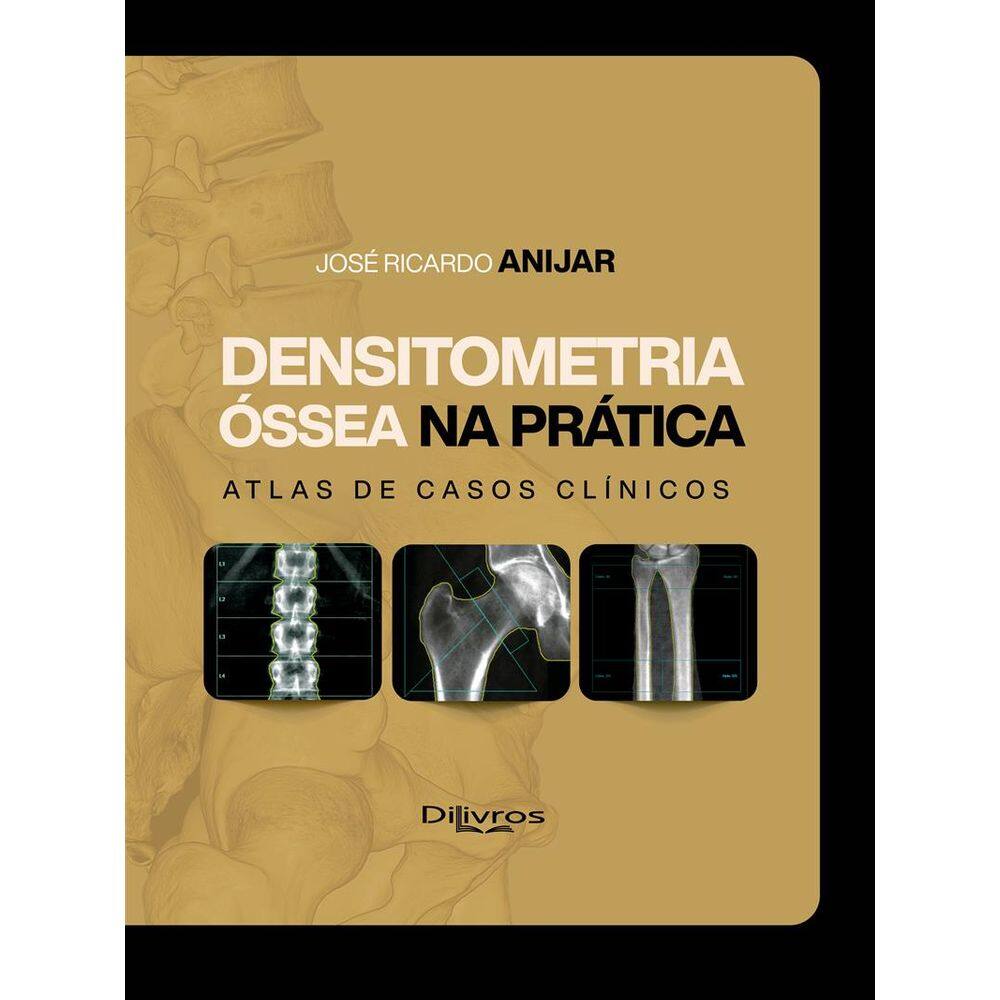 Densitometria Ossea Na Pratica