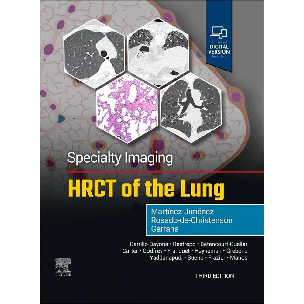 Specialty Imaging Hrct Of The Lung