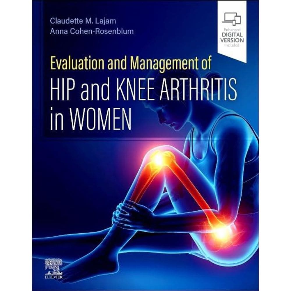 Evaluation And Management Of Hip And Knee Arthritis In Women