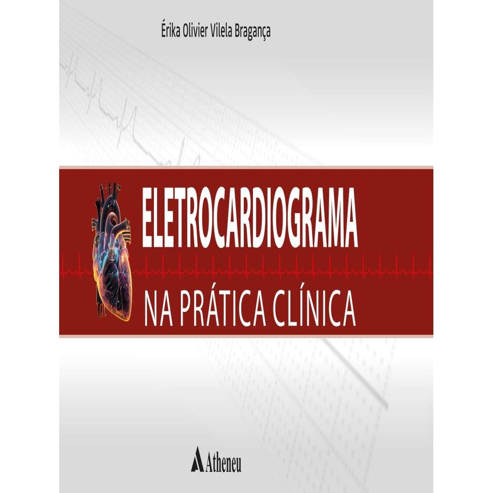Eletrocardiograma Na Pratica Clinica