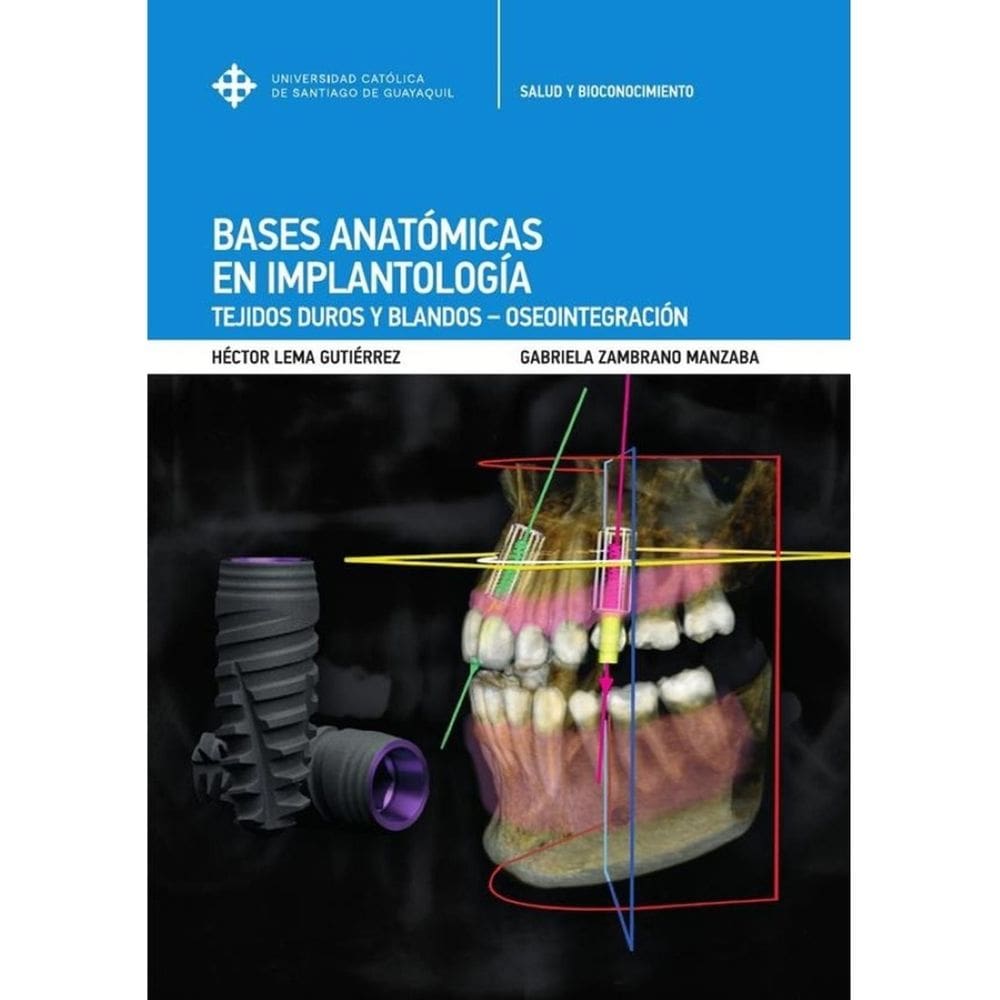 Bases anatómicas en implantología : tejidos duros y blandos - oseointegración - Espanhol