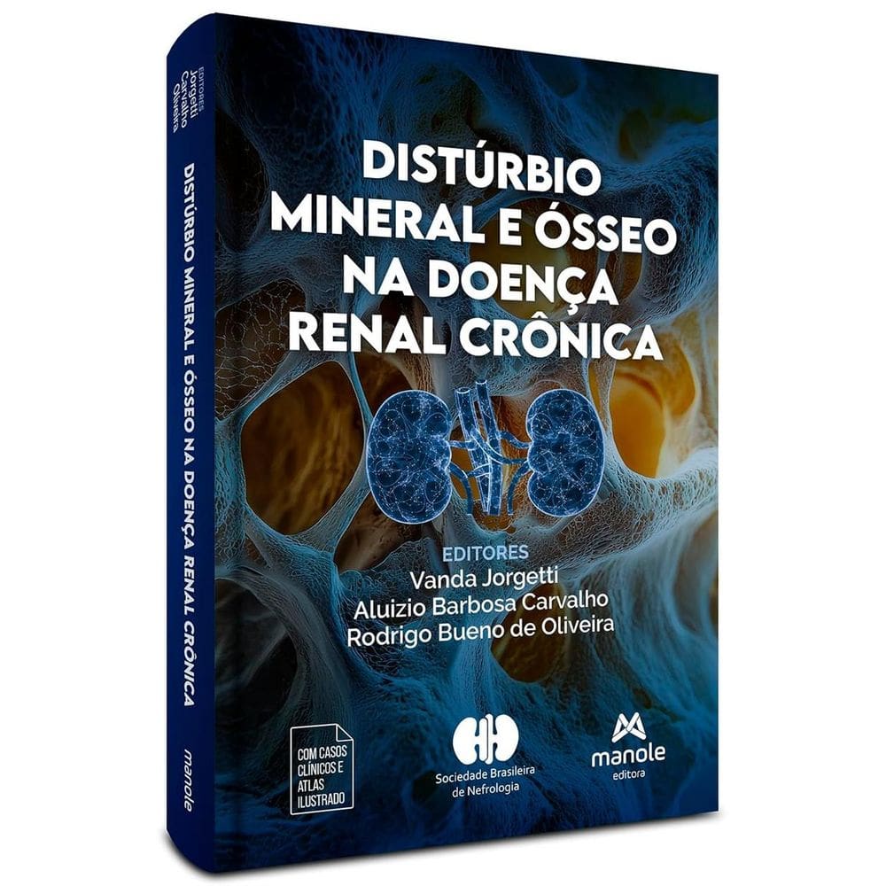 Distúrbio Mineral e Ósseo na Doença Renal Crônica
