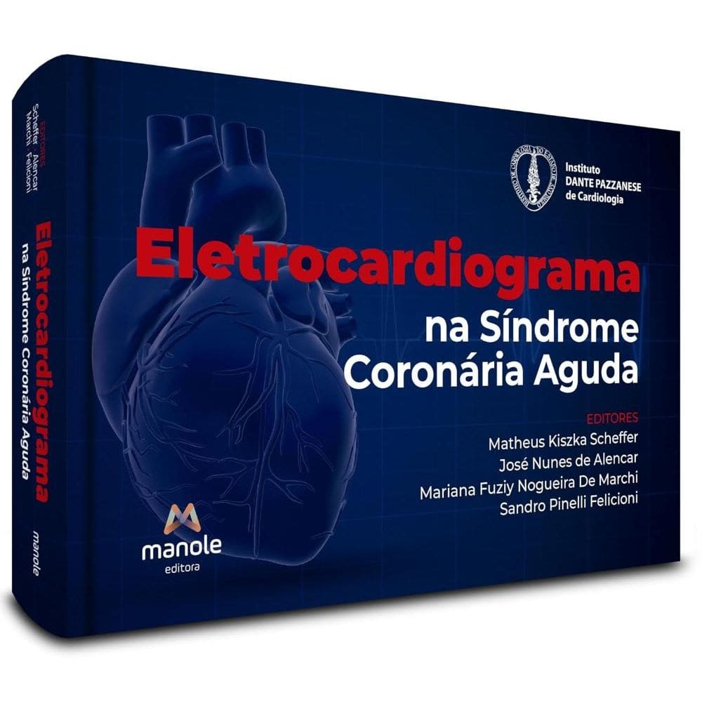 Eletrocardiograma na síndrome coronária aguda (1010)