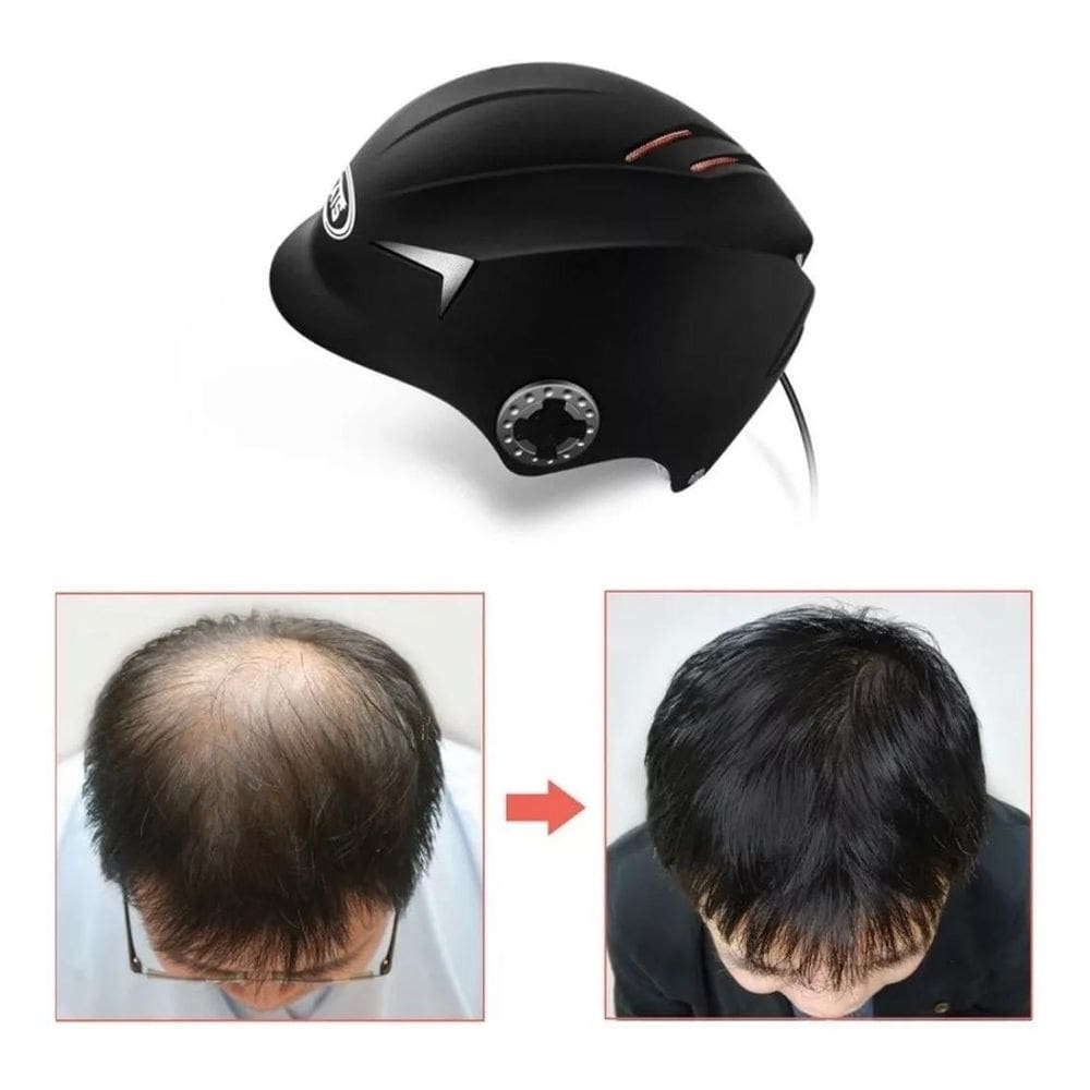 Capacete Laser Diodo Calvicie Tratamento Cabelo Antiquedaats