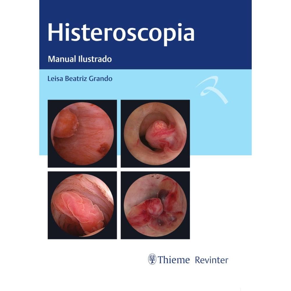 Histeroscopia