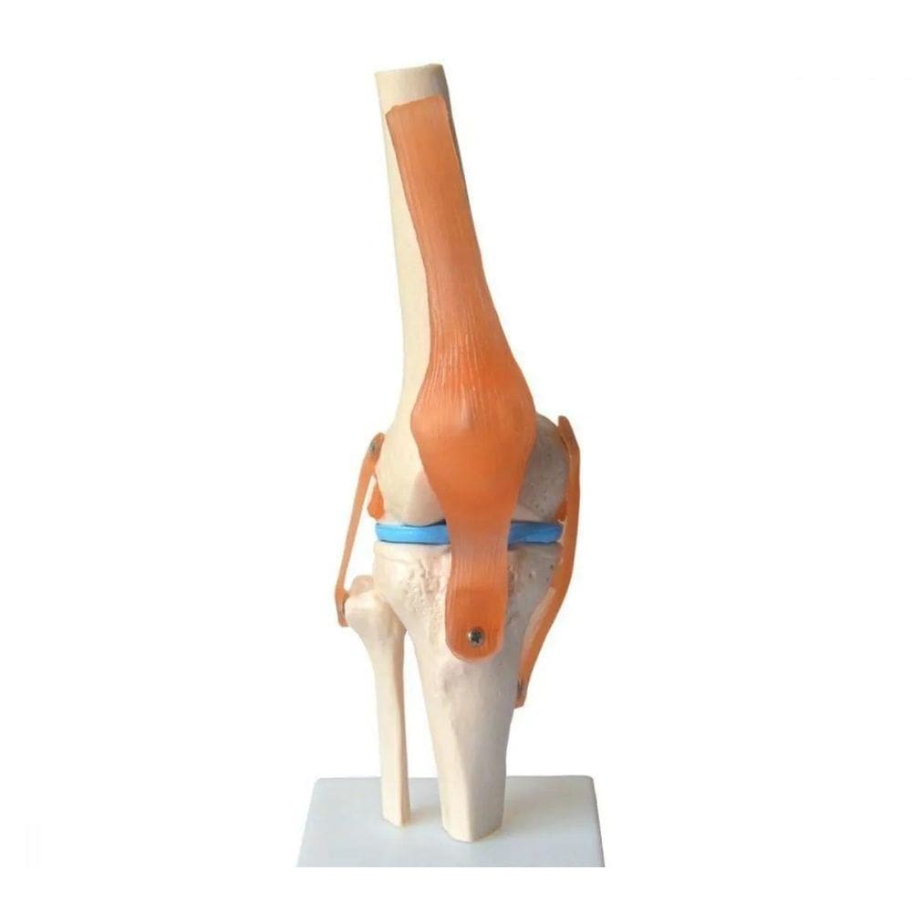 Articulação Do Joelho Com Ligamentos
