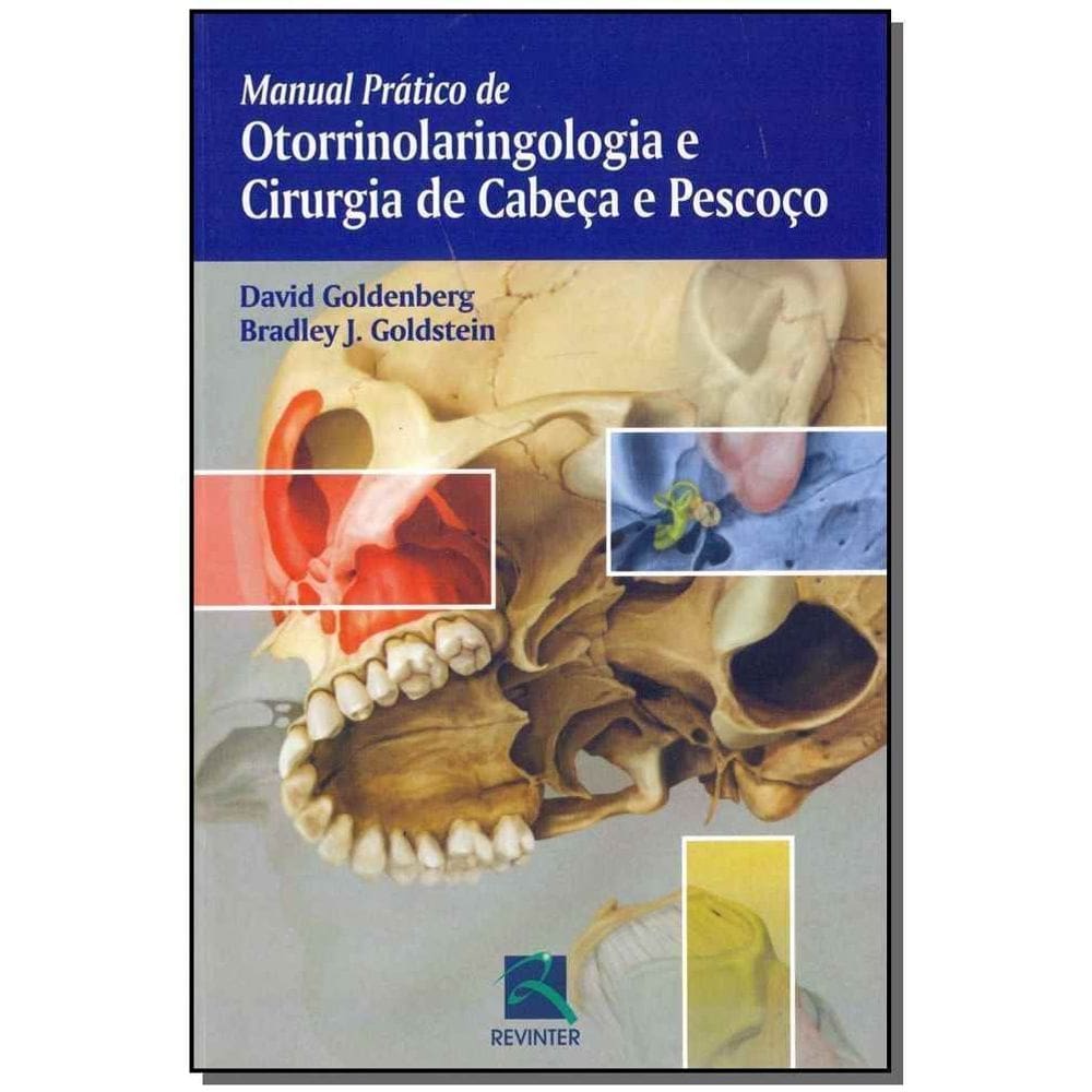 Manual Prático de Otorrinolaringologia e Cirurgia de Cabeça e Pescoço