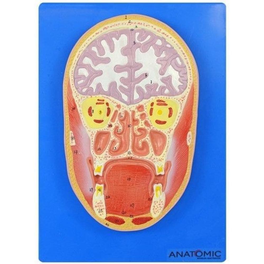 Cabeça Humana Em Corte Frontal E Cérebro