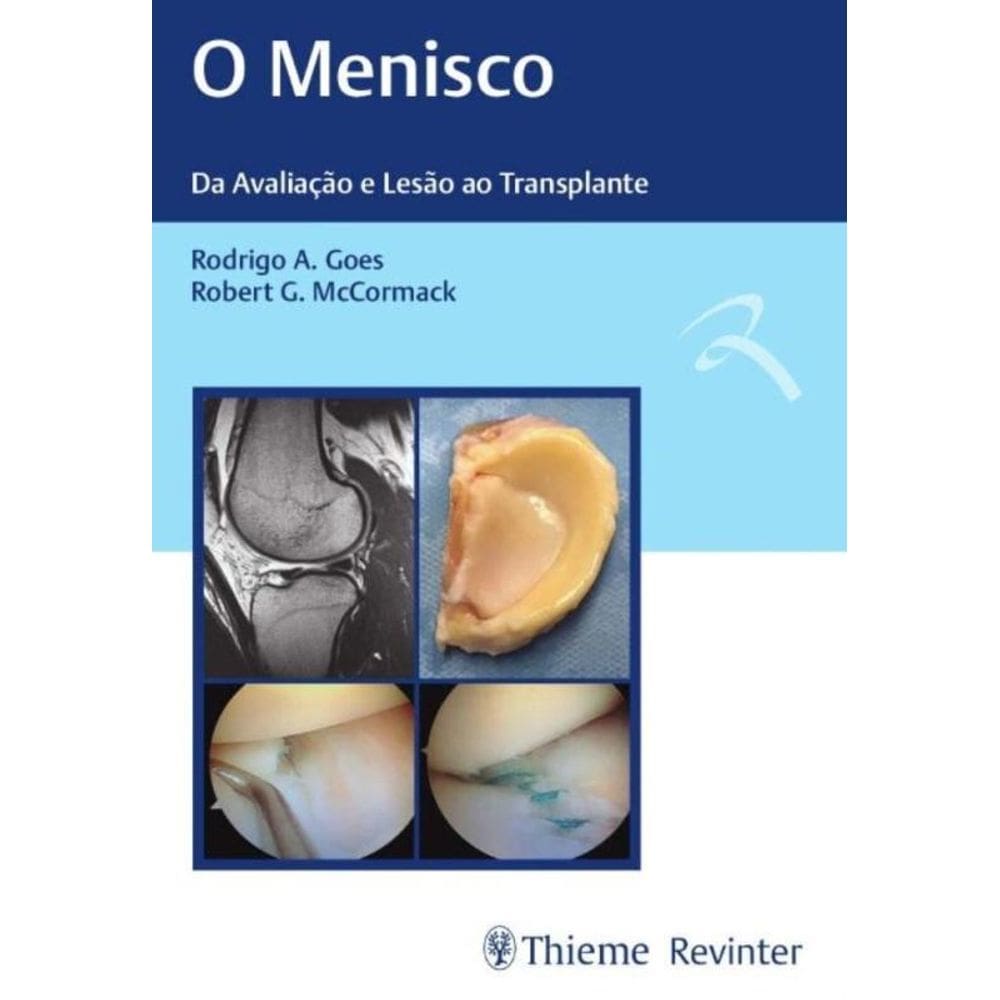 o Menisco - Da Avaliação e Lesão Ao Transplante