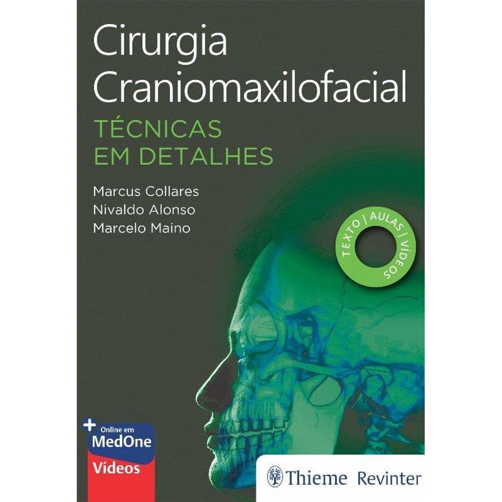 Cirurgia Craniomaxilofacial Tecnicas Em Detalhes