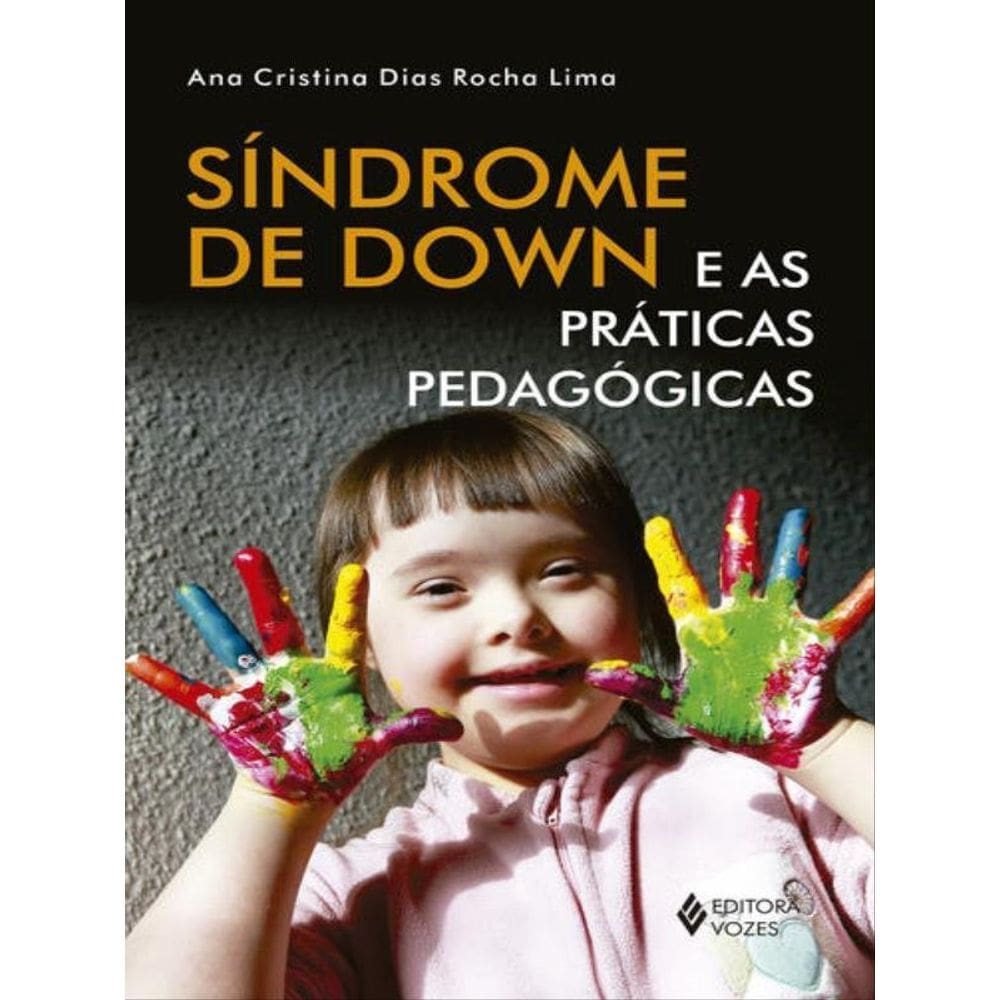 Síndrome De Down E As Práticas Pedagógicas