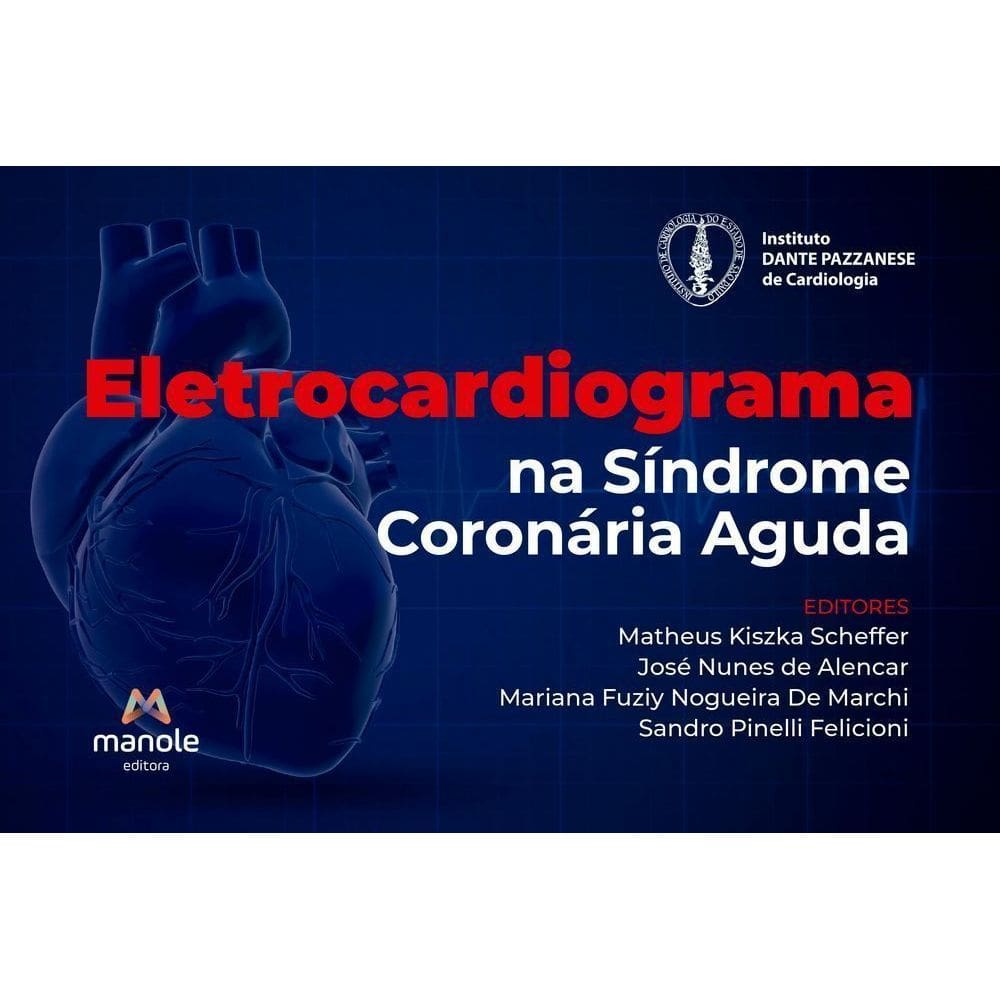 Eletrocardiograma Na Síndrome Coronária Aguda