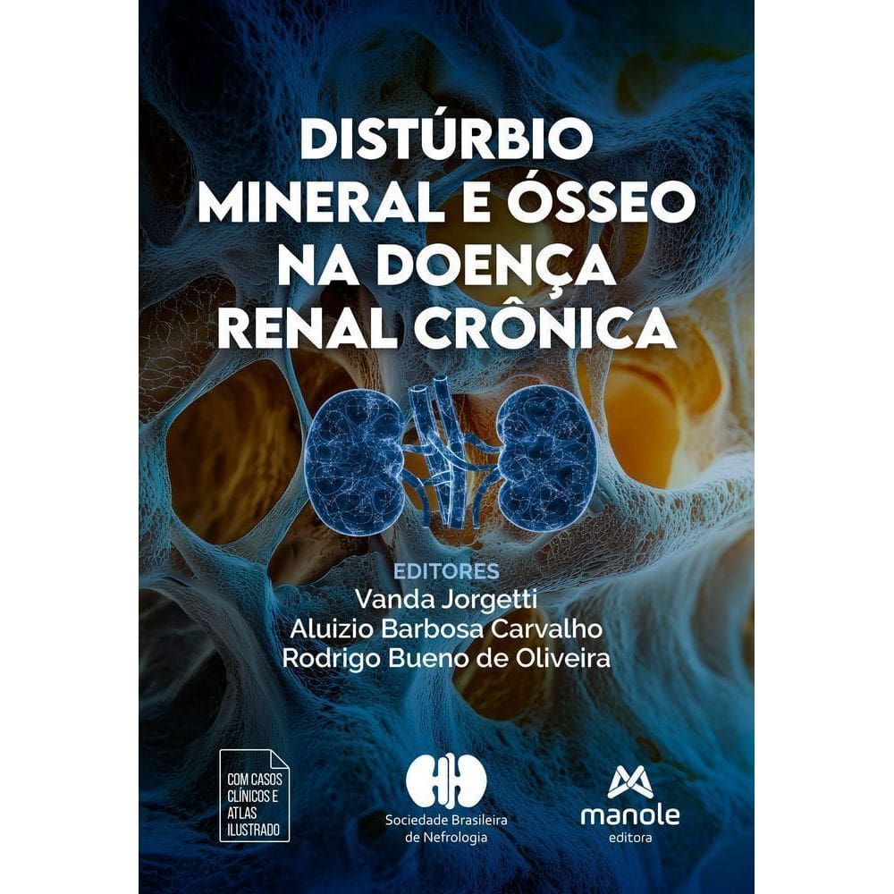 Distúrbio Mineral E Ósseo Na Doença Renal Crônica