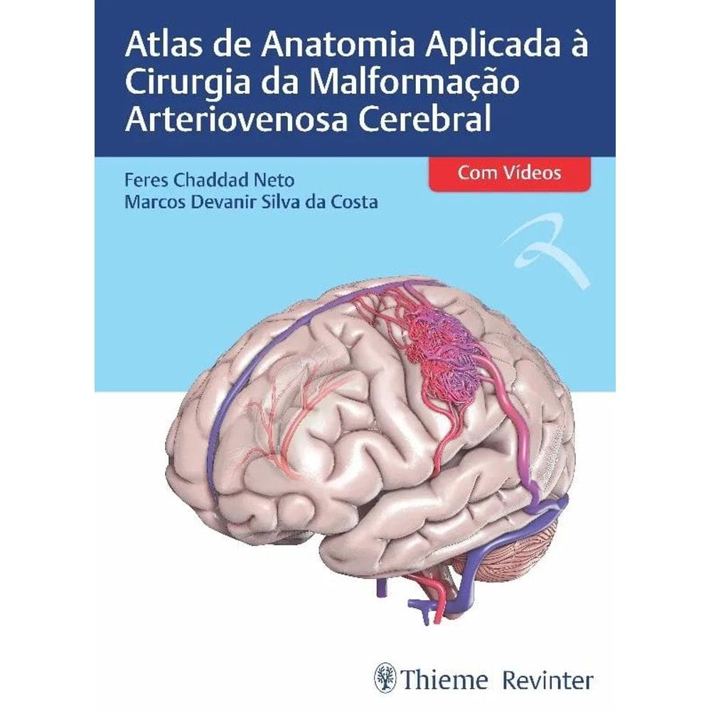 Atlas De Anatomia Aplicada Cirurgia Da Malformacao Arteriovenosa Cerebral