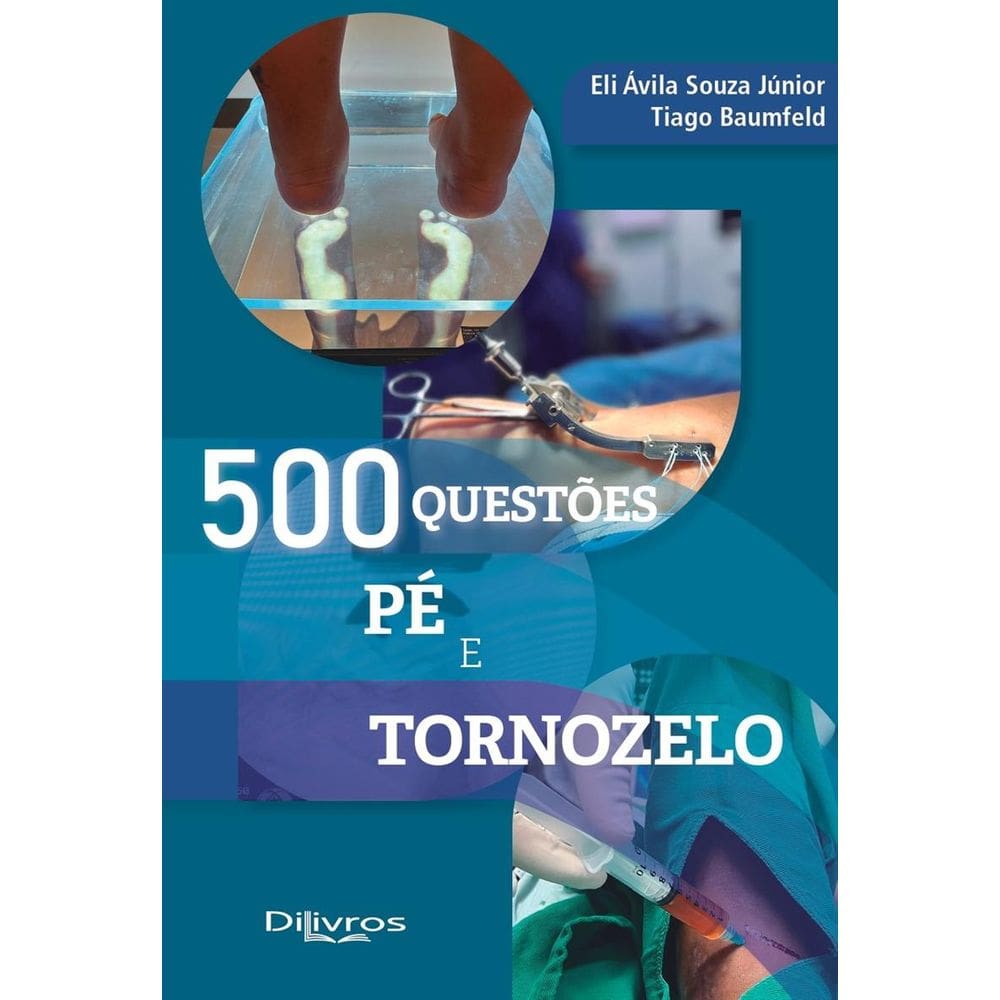 500 Questões: Pé e Tornozelo