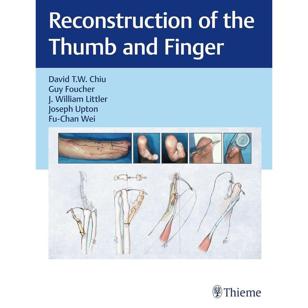 Reconstruction of the Thumb and Finger