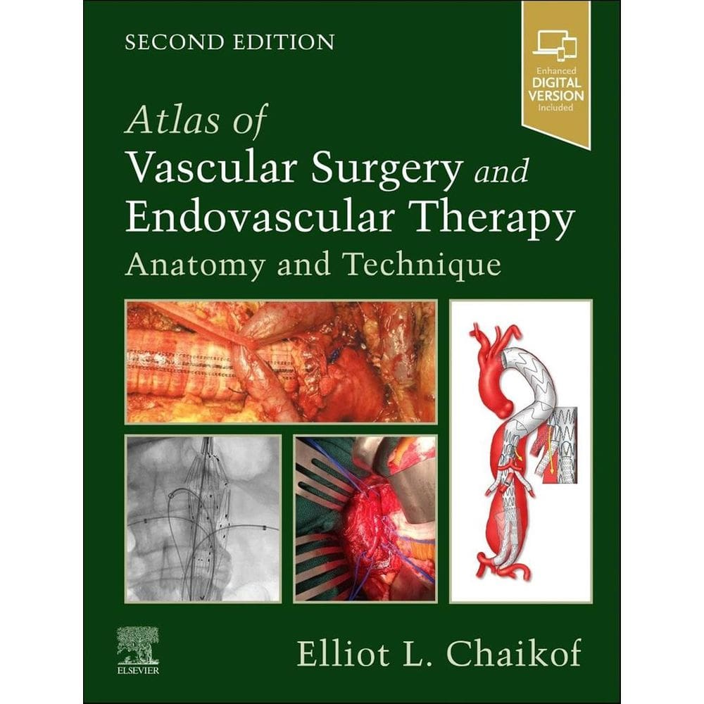 Atlas Of Vascular Surgery And Endovascular Therapy