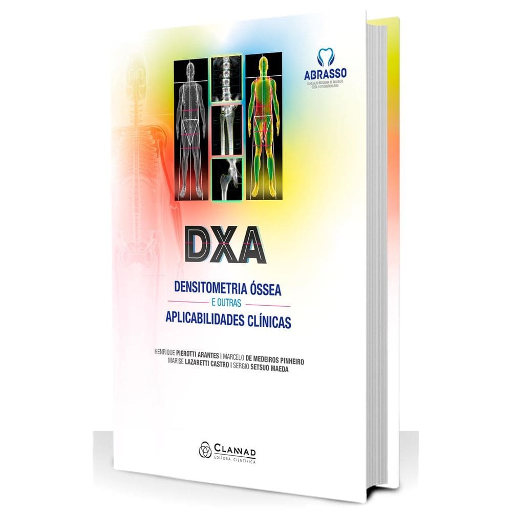 Dxa  Densitometria Ossea E Outras Aplicabilidades Clinicas