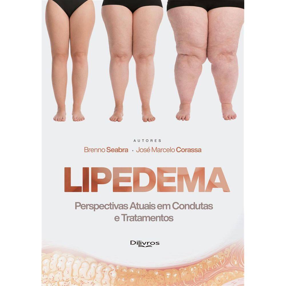 Lipedema Perspectivas Atuais Em Condutas E Tratamentos