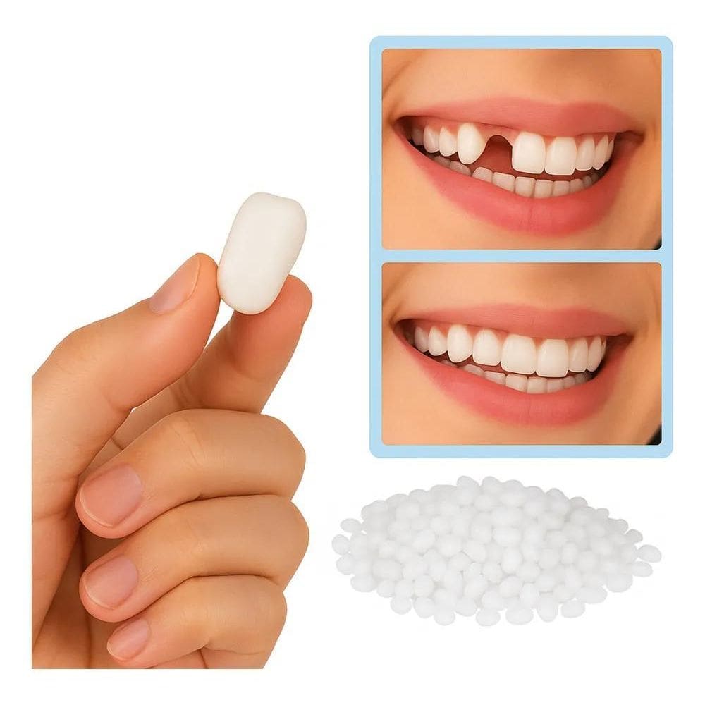 Massa Restauração Dente, Tampa Buraco Dental. Provisórios