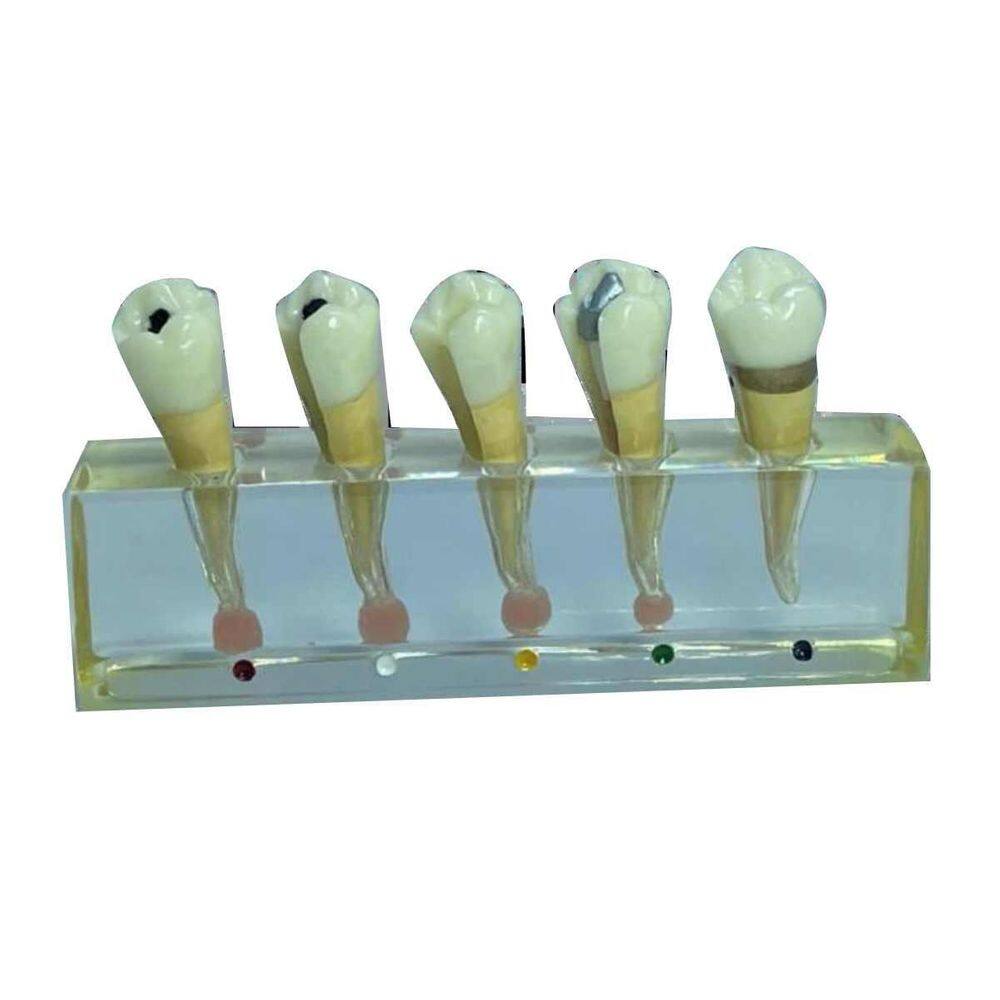 Macro Modelo Anatômico Odontológico Endodontia 4 Elementos