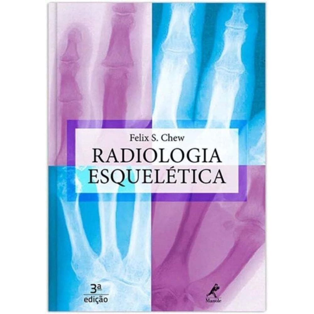 Radiologia Esqueletica
