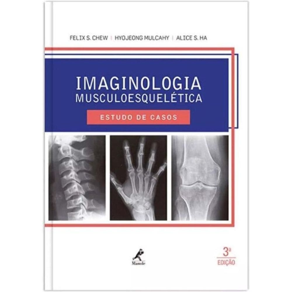 Imaginologia Musculoesqueletica