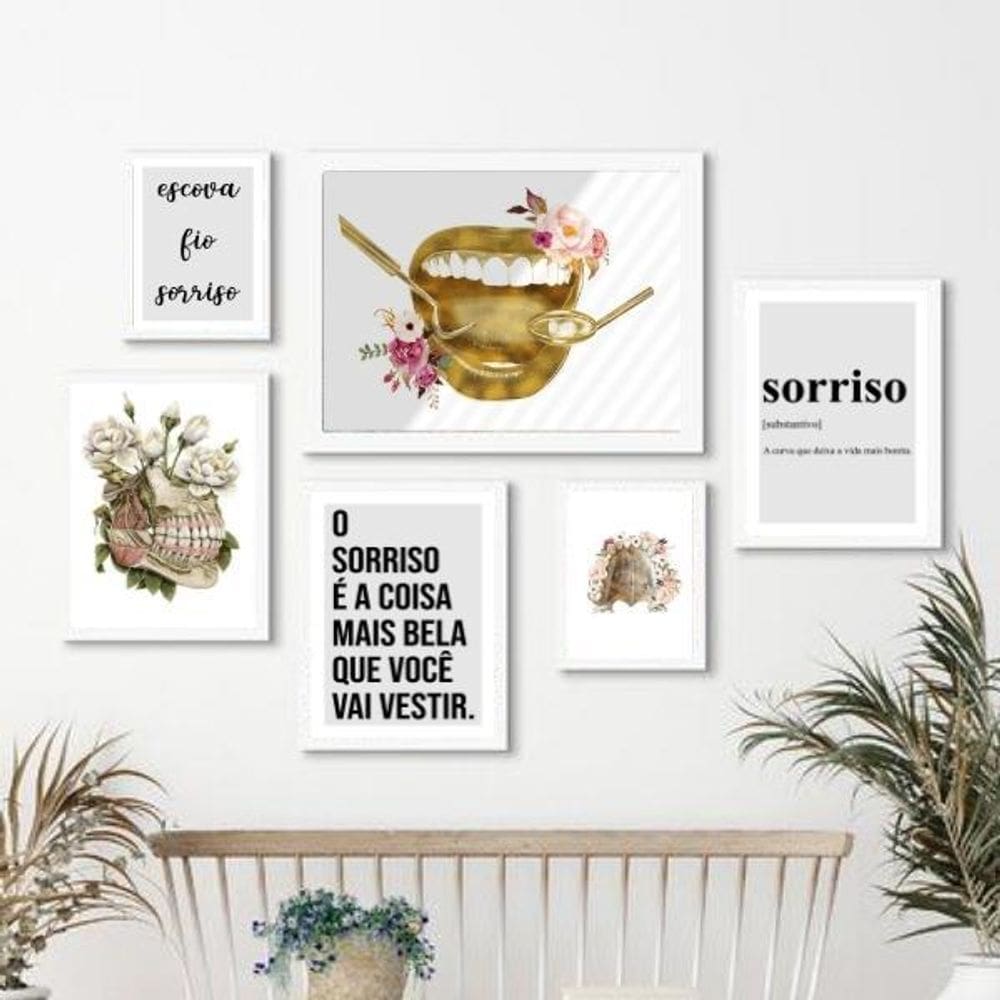 Kit 6 Quadros Odontologia Sorriso - Madeira Branca, Vidro