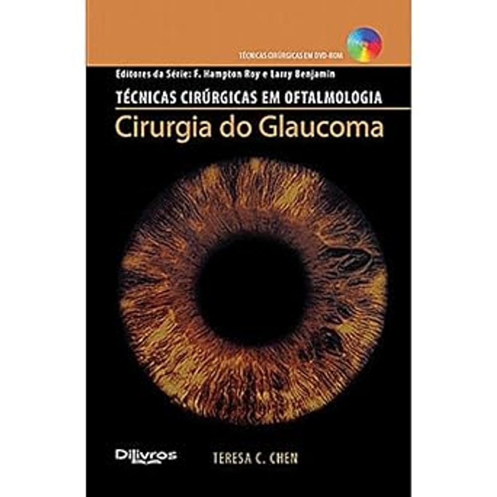 Técnicas cirúrgicas em oftalmologia, Cirurgia do Glaucoma