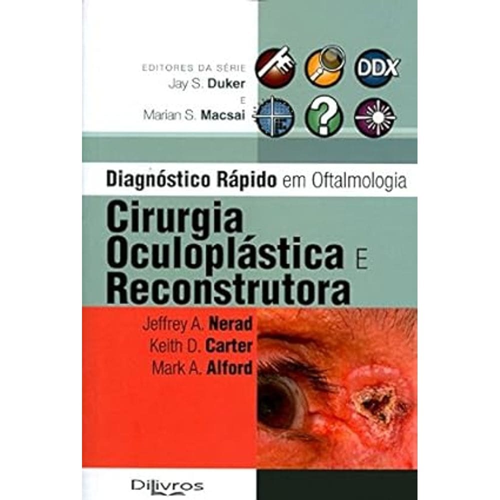 Diagnóstico Rápido em Oftalmologia, Cirurgia Oculoplástica e Reconstrutora